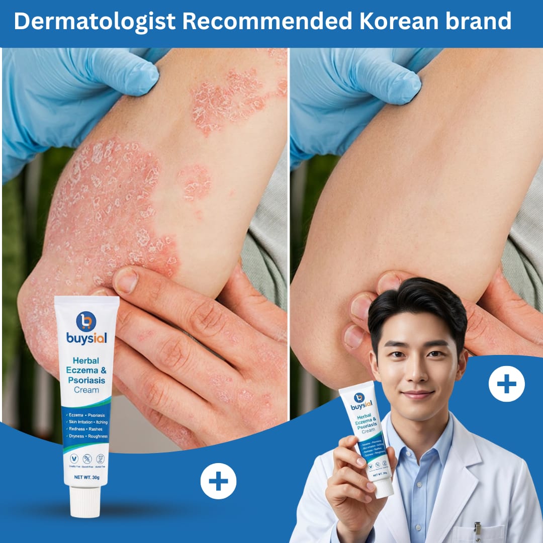 Dermatologist recommended Buysial Herbal Eczema and Psoriasis Cream
Korean brand showing before and after psoriasis treatment on elbow
with doctor holding product