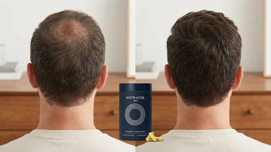 Men’s hair growth supplements for thicker, stronger hair support
