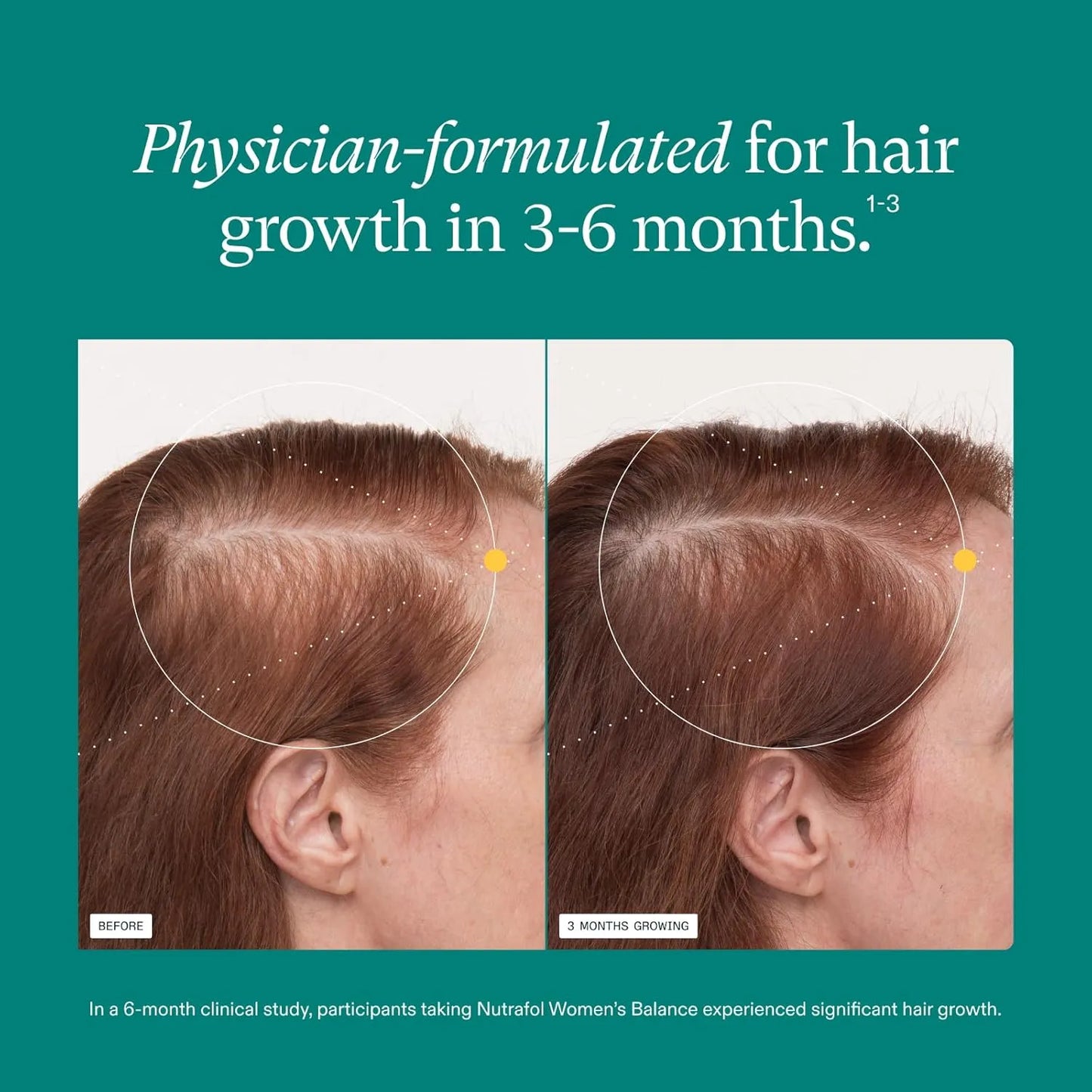 Nutrafol Women’s Hair Growth Supplements (Ages 18–44), 1 Month Supply