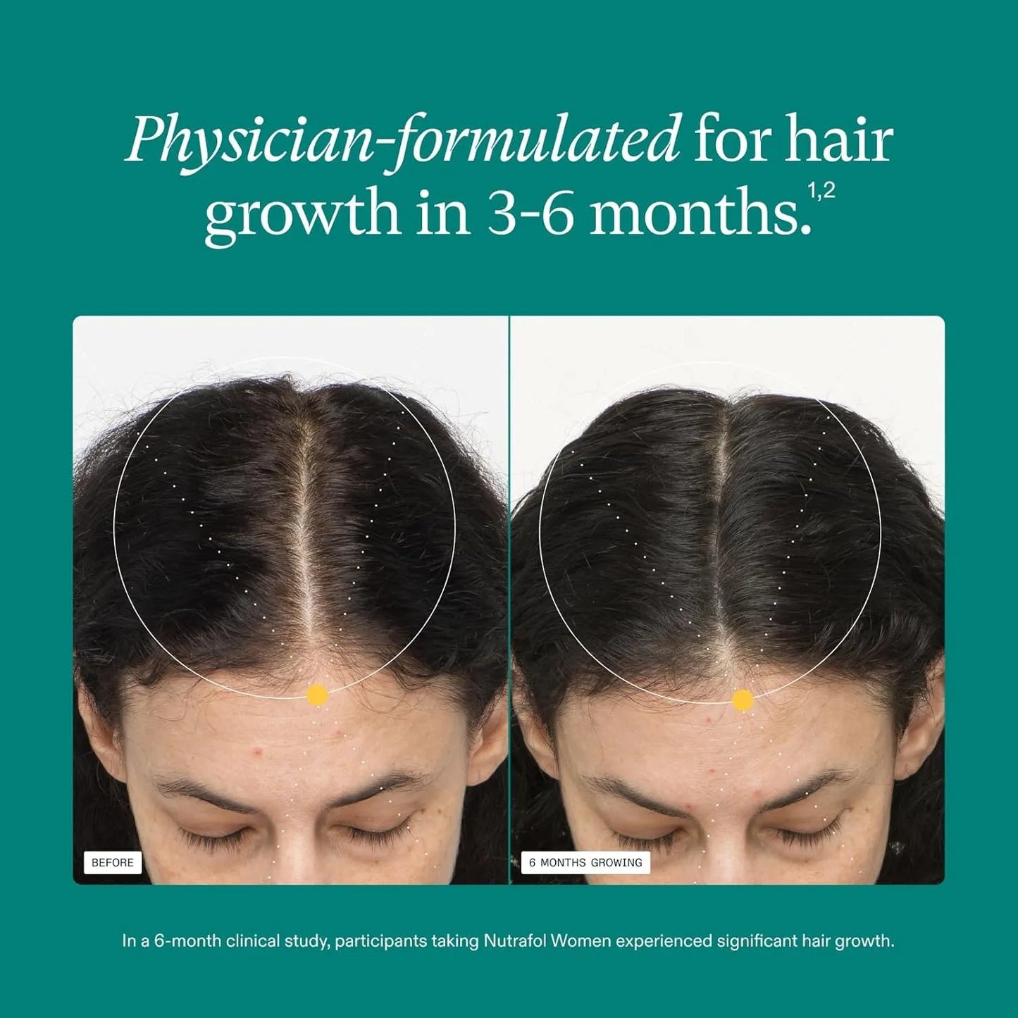 Nutrafol Women’s Balance Hair Growth Supplements (45+)| 1 Month Supply
