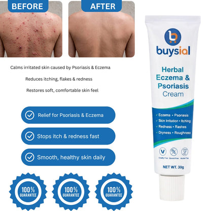 Before and after results of Buysial Herbal Eczema Psoriasis Cream 
showing clear skin on back after treating redness, itching, rashes 
and rough skin with herbal cream