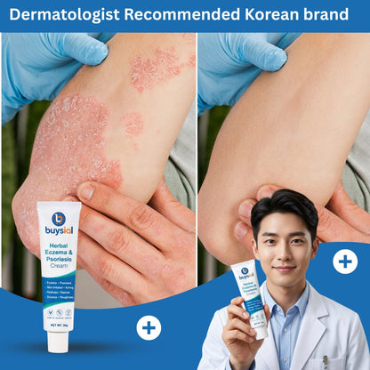 Dermatologist recommended Buysial Herbal Eczema and Psoriasis Cream 
Korean brand showing before and after psoriasis treatment on elbow 
with doctor holding product